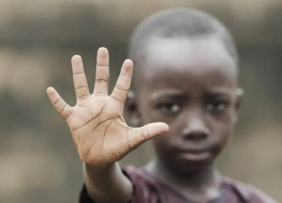منظمة الأمم المتحدة للطفولة أطفال السودان في وضع كارثي 
