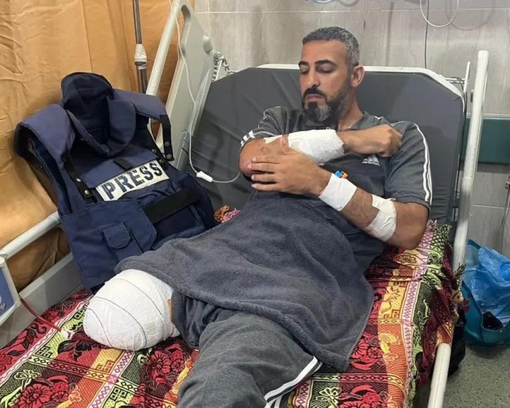 نقابة الصحفيين الفلسطينيين تطالب بالإجلاء الطبي العاجل لزملائها المرضى والمصابين في قطاع غزة