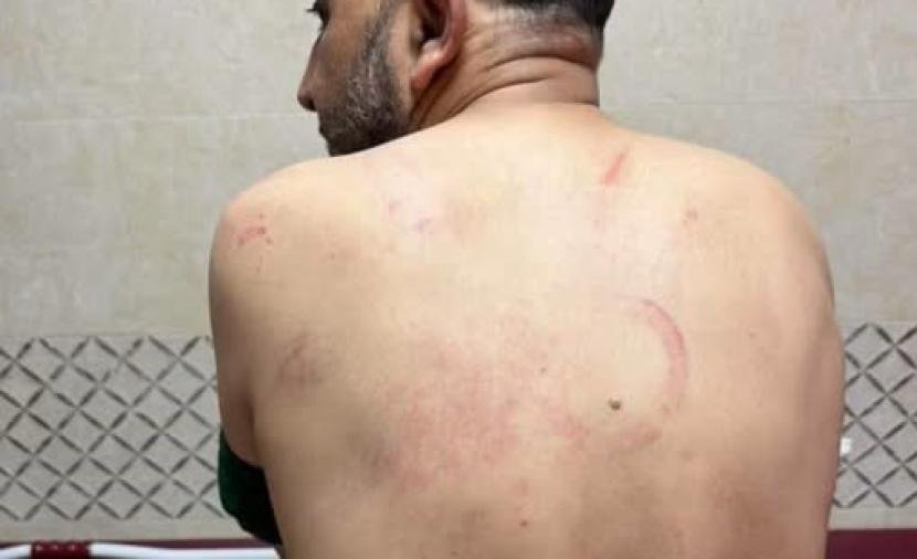 ناشط فلسطيني يكشف تفاصيل محاولة اغتيال داخل نظارة جنين